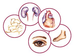 The organ of diabetes complications